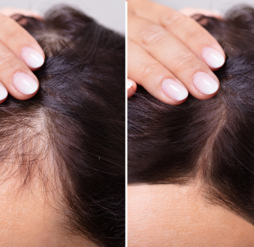 Cosmetologist trivandrum