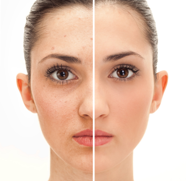 best skin clinic in trivandrum