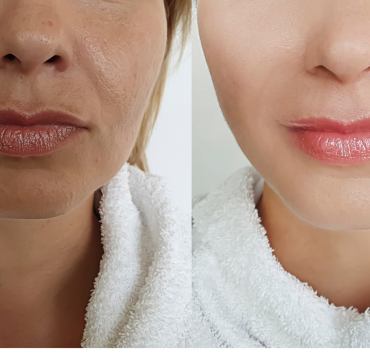 beauty clinic trivandrum