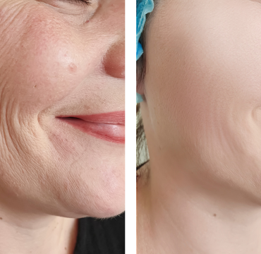 skin clinic trivandrum